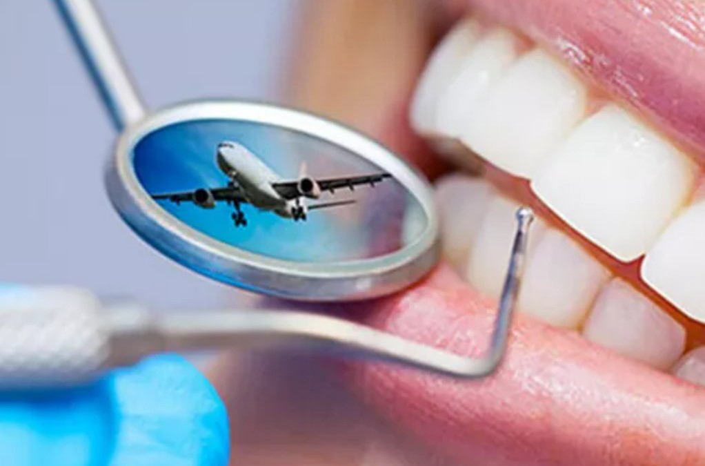 mouth dental implants